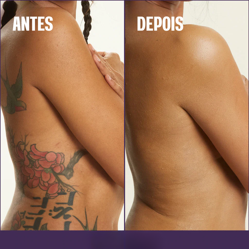 Base Corporal Iluminadora - Remove Manchas✨