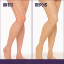 Base Corporal Iluminadora - Remove Manchas✨