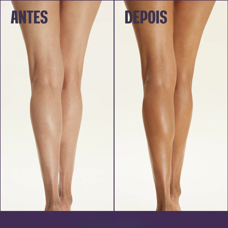 Base Corporal Iluminadora - Remove Manchas✨