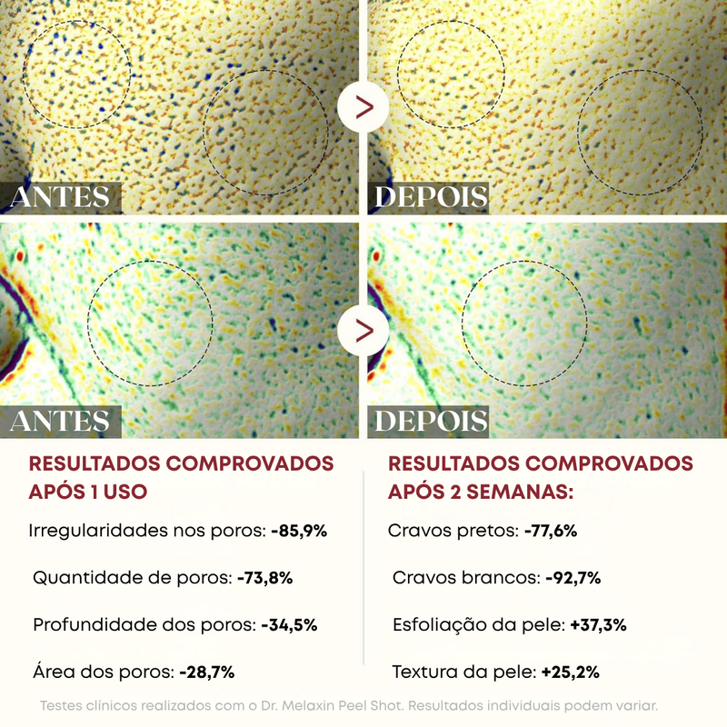 Dr. Melaxin™ Peel Shot – Esfoliante de Arroz (80ml)